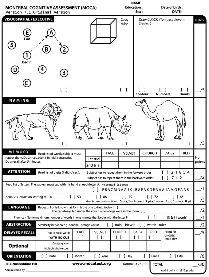 Montreal Cognitive Assessment infographic